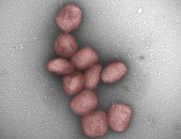 Un estudo do CSIC mostra a presenza do virus Mpox no aire e na saliva de pacientes infectados 